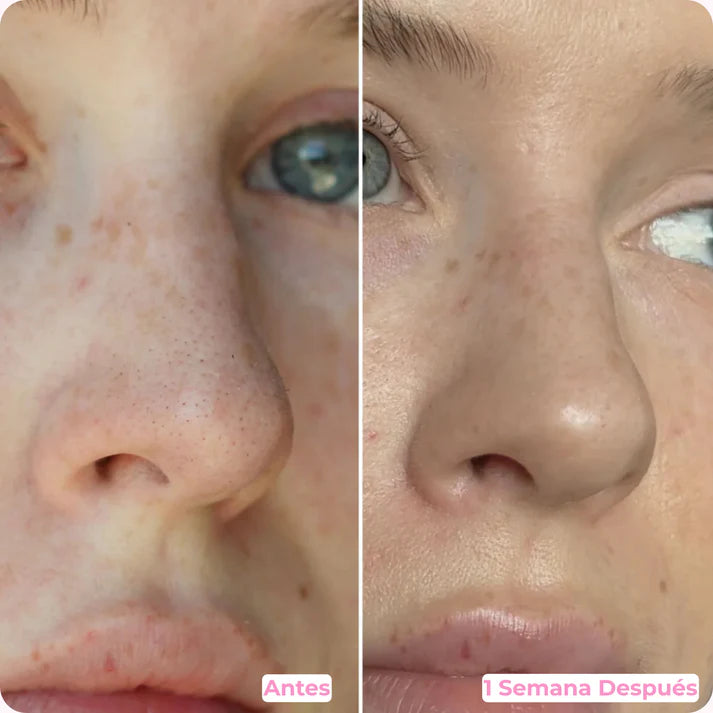 Espátula Facial Ultrasónica SonicGlow™ Inalámbrico 3 en 1🔋